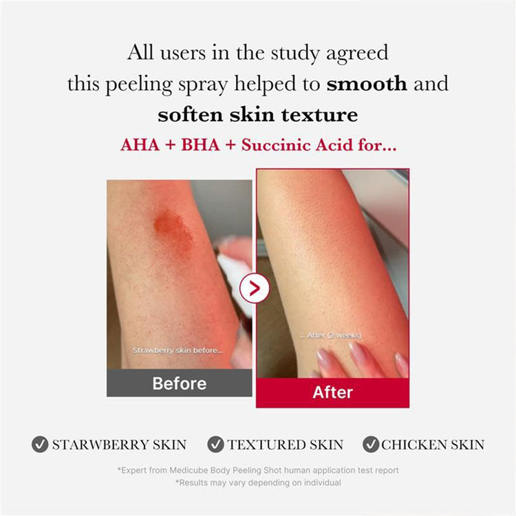 اسپری لایه بردار و ضد جوش بدن مدی کیوب Medicube Red Acne Body Peeling Shot